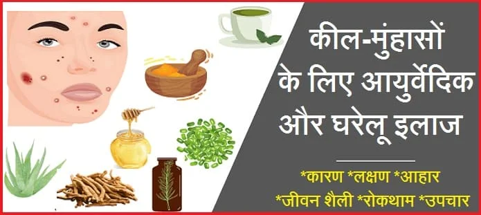 मुंहासों का आयुर्वेदिक और घरेलू इलाज