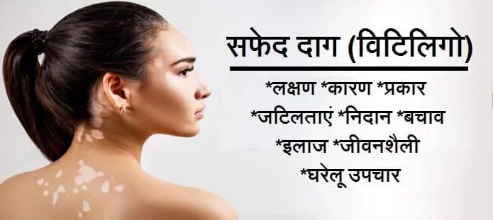 सफेद दाग: लक्षण, कारण, जटिलताएं, निदान, बचाव और इलाज