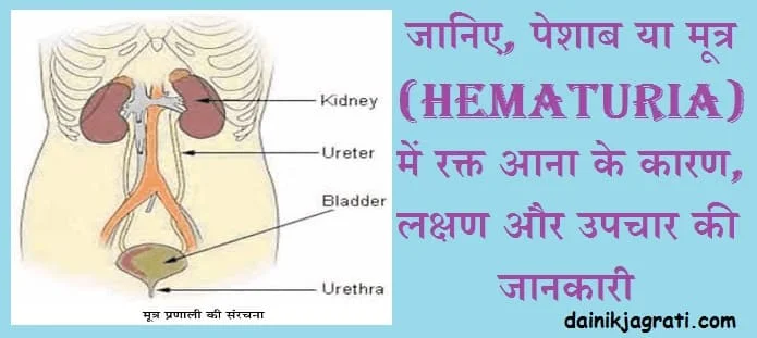 पेशाब में रक्त आना