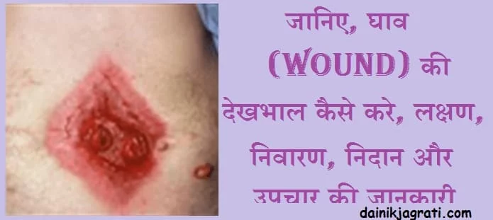 घाव की देखभाल