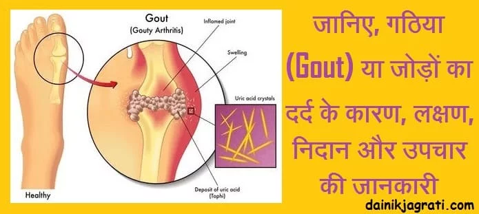जोड़ों में दर्द