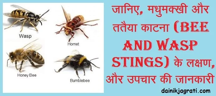 मधुमक्खी और ततैया काटना