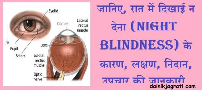 रात में दिखाई न देना