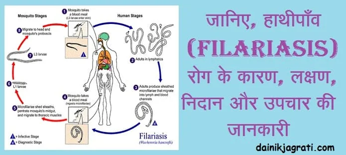 हाथीपांव
