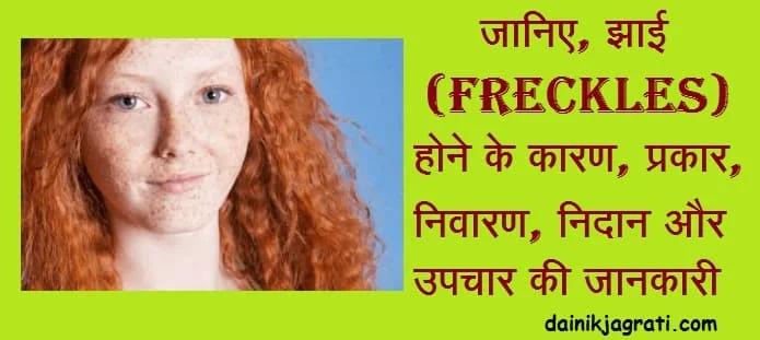 झाई