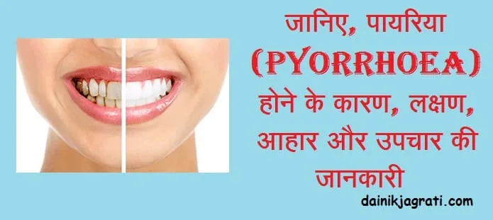 पायरिया