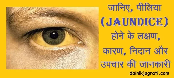 पीलिया
