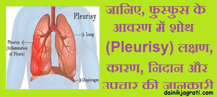 फुस्फुस के आवरण में शोथ